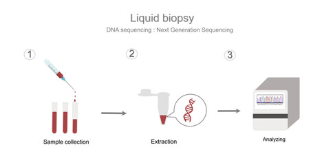 The workflow step of DNA sequencing with Next Generation sequencing technique in sample of liquid biopsy that represent in three simple step: Sample collection (blood), Extraction and Analyzing.
