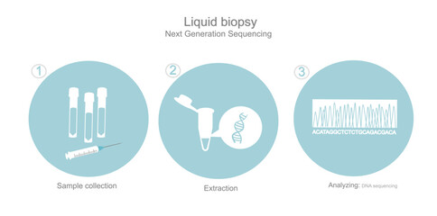 The detection icon of DNA sequencing with next generation sequencing technique in the sample of liquid biopsy that including simple step of Sample collection (Blood), Extraction and Analyzing.