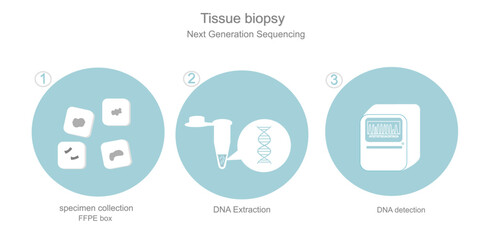The workflow icon of DNA sequencing in Tissue biopsy with Next Generation Sequencing technique on blue and white concept that shows 3 step of specimen collection (FFPE), extraction and DNA detection.
