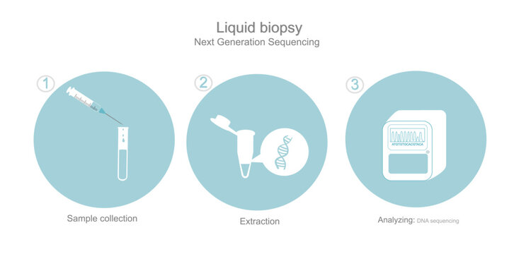 The icon of DNA sequencing workflow with next generation sequencing technique in sample of Liquid biopsy (blood) of three step : Sample collection(Blood), Extraction and Analyzing.