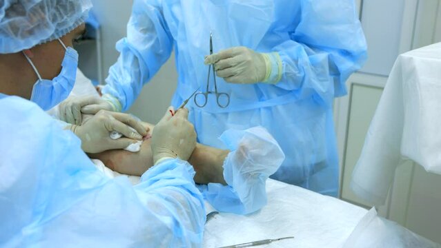 Surgeon phlebologist venoextractor takes out the affected area of the vein for removal. Process of surgery for the treatment of varicose veins