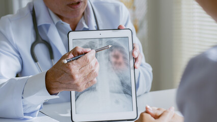 Senior Asian doctor showing lung x-ray test results and describe to a young woman patient in...