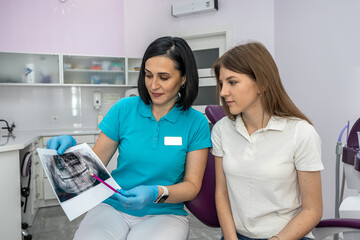 Fototapeta premium dentist doctor shows a picture of the jaw of a young patient.