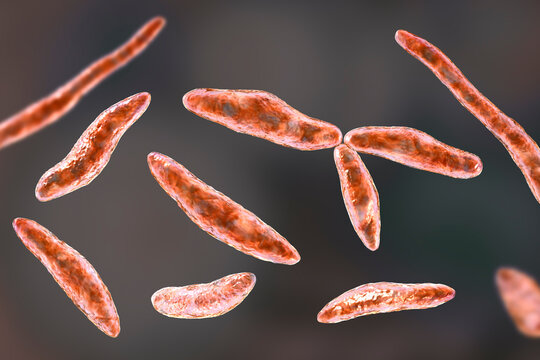 Peritonitis Bilder Durchsuchen 1,417 Archivfotos, und