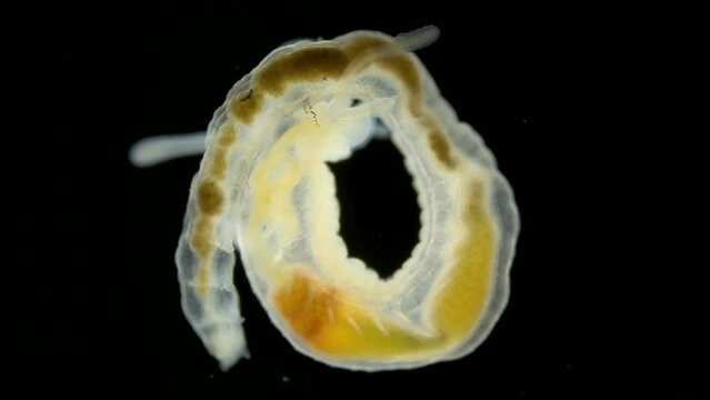 Worm Polychaeta, family Terebellidae under the microscope. Sample found in the Barents Sea