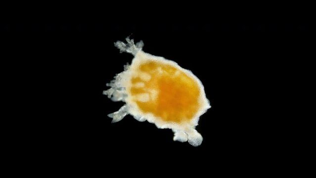 Pentacula Holothuroidea larva, Juvenile sea cucumber under microscope, type Echinodermata, a very unusual organism, at this stage, she sank to bottom and crawled in search of food. Barents Sea