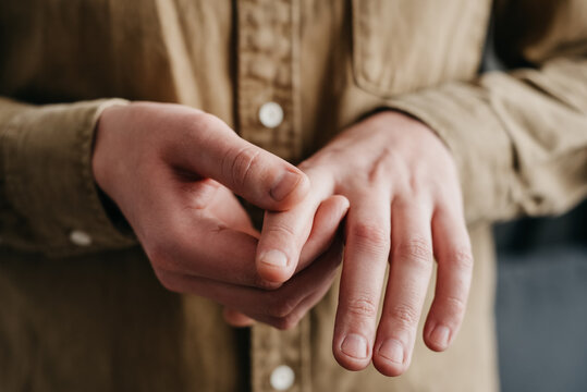 Close up of unhealthy young caucasian man suffering from arthritis in fingers. Cause of pain include rheumatoid arthritis, carpal tunnel syndrome, trigger finger or gout. Health care concept