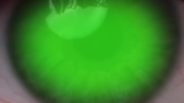 Zoom in on the human eye on the green background inside. Chroma Key Green, mockup for video