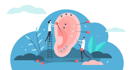 Acupuncture illustration, transparent background. Flat tiny needle therapy persons concept. Alternative medicine form with body injection points as pain killer. Chinese traditional medicine.