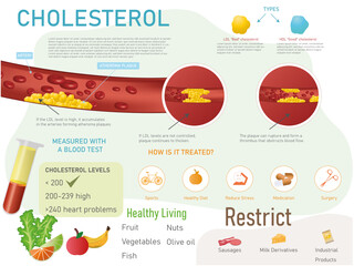 Cholesterol infographic, what it is, types, treatment and recommended and forbidden foods with corresponding icons on white background.