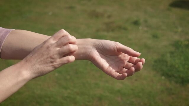 The female scratches her hand, insect bites. Allergic reaction to insect bites, dermatitis. Allergy rash