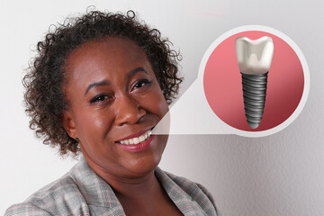 Happy African American woman with perfect teeth smiling on white background. Illustration of dental implant