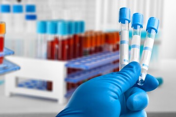 Doctor's hand hold a test tubes