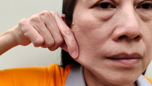 portrait the flabbiness and wrinkle beside the cheek, dark spots and rough skin, freckles and blemish on the face, cellulite and bag under the eyes, health care and beauty concept.