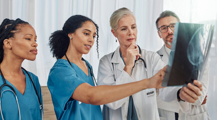 Xray, doctors and nurses, team and health with analysis of brain scan and neurology medical group....