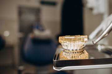 orthodontic model and dentist tool - demonstration teeth model of varities of orthodontic
