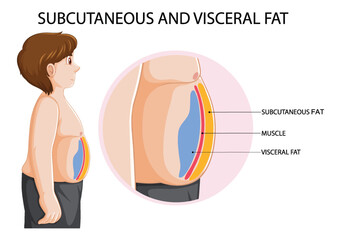 Subcutaneous and visceral fat diagram