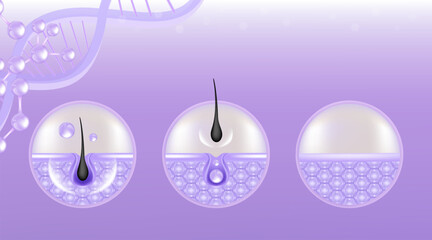 Hyaluronic acid before and after hair and skin solutions ad, purple removing serum drop over skin cells with cosmetic advertising background ready to use, illustration vector.	