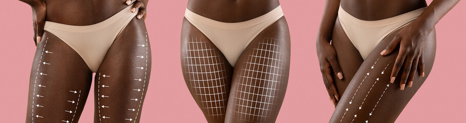 Young black women in beige lingerie with lines for body shaping or drainage massage isolated on pink background