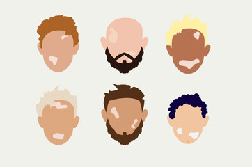 Male faces with vitiligo skin disease. Portraits with different ethnics, skin colors, hairstyles. Flat vector illustration