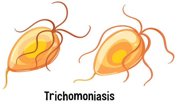 Trichomonas vaginalis with text