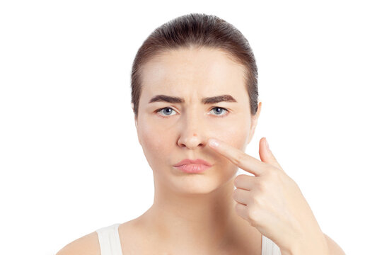 Woman shows her pimple on her nose, she has an acne. Woman has a problematic skin. Close-up photo on a white background