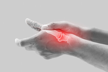 Arthritis of the finger and thumb joint. - obrazy, fototapety, plakaty
