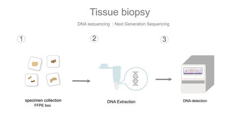 The workflow of DNA sequencing in the sample of tissue biopsy with Next Generation Sequencing technique that represent in three simple step: Sample collection (FFPE box), Extraction and Analyzing.