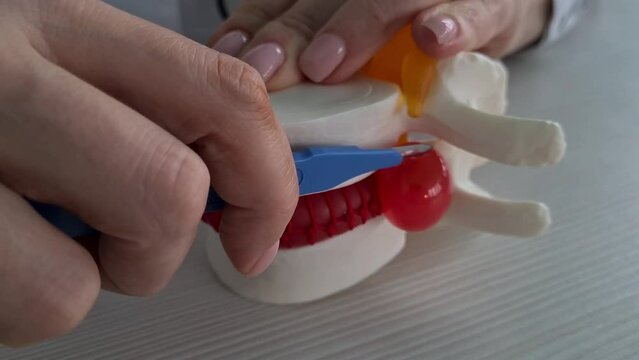 Neurosurgery and operations on spinal cord of spine. Spinal cord model with nerve roots and surgeon hand in with scalpel