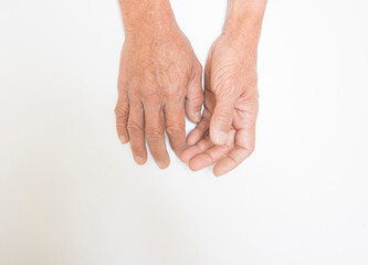 Dry and wrinkled skin of the hands of the elderly against a white space backdrop