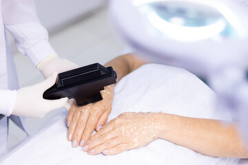 Obraz na płótnie Canvas Aesthetic procedure on hands, rejuvenation, skincare