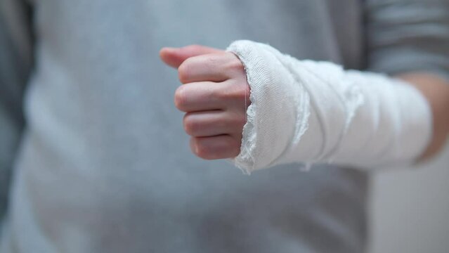 The broken arm of a man in gaps. Plaster cast on a broken arm close-up.