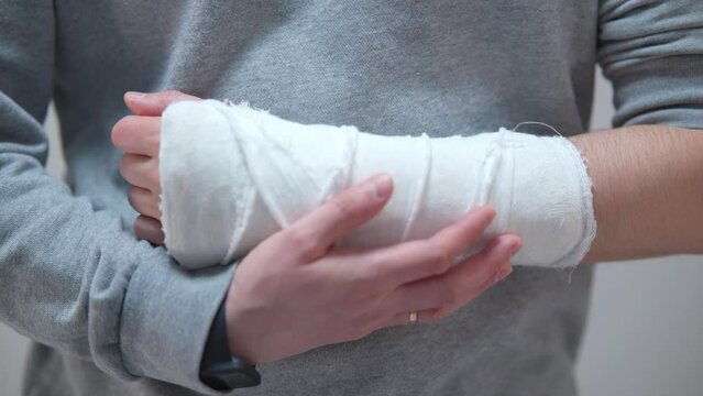 The broken arm of a man in gaps. Plaster cast on a broken arm close-up.