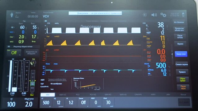 Utrasound image on the monitor close-up. Ultrasound Scan display. Ultrasound examination Using Scanner. Echocardiography. Screening Ultrasonography Analysis of person. Ultrasound Scan Device.