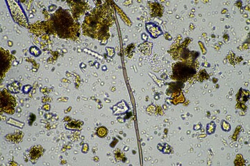 soil microorganisms in a soil sample, soil fungus and bacteria on a regenerative farm in compost....