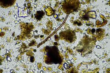 soil microorganisms in a soil sample, soil fungus and bacteria on a regenerative farm in compost. fungi hyphae in a soil test. in australia © William