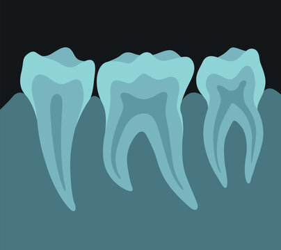 X Ray Image Of Teeth Dental Equipment Medical Surgery Radiogram Photo Vector Flat Illustration