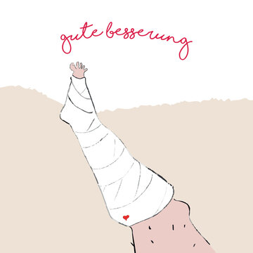 Gebrochenes Bein. Gipsbein. Gute Besserung. Vektorillustration