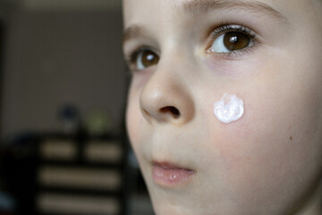 Little boy with acne cream. Acne cream on the face of a little boy. Problematic skin