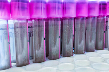 A rack of vacuum venipuncture test tubes for isolating blood samples and performing blood tests