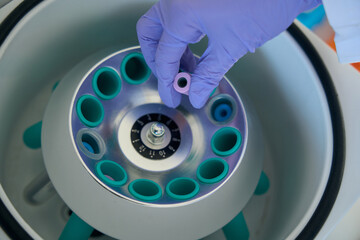 Man puts a test tube with biomaterial into hematological centrifuge