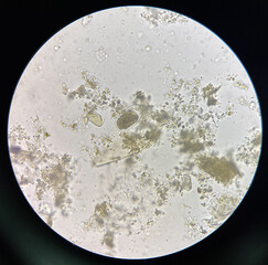 Hookworm egg human parasite in stool examination test.