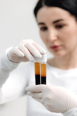 Doctor cosmetologist draws blood plasma into a syringe for the plasmolifting procedure, hands in gloves closeup. PRP therapy treatment in beauty clinic. Cure of problem skin.