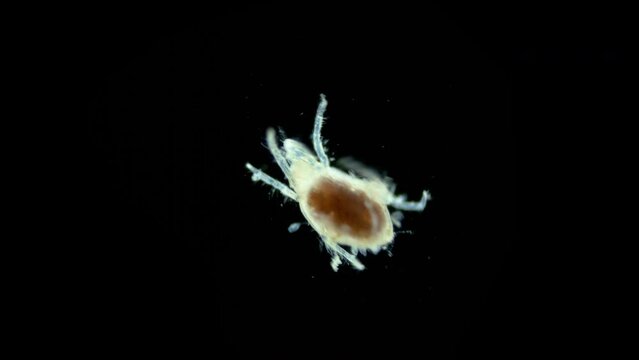Acari(mite) living in water under a microscope, the superfamily Halacaroidea, order Trombidiformes, live in both fresh and sea water. Barents Sea