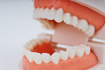 歯列模型と白い背景