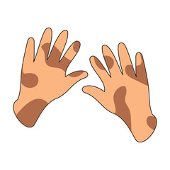 Dirty hands poster in doodle style. Dirtyliness hands vector illustration. Poster skin cleanliness.