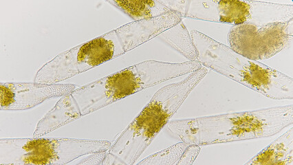 Marine diatom called Isthmia. Lugol preserved sample. Marine phytoplankton. 400x magnification with...