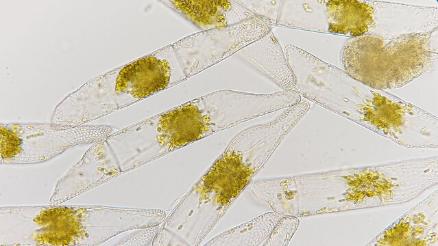 Marine diatom called Isthmia. Lugol preserved sample. Marine phytoplankton. 400x magnification with selective focus