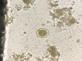 Ascaris lumbricoides  egg human parasite.