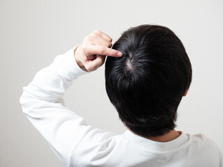 男性の後頭部　髪の毛　つむじ